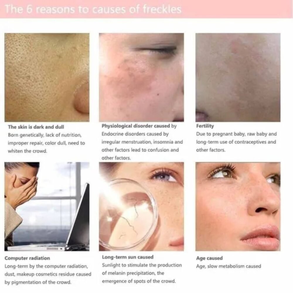 Glint Your Face With You Bello Skin Whitening Night Whitening Cream (Imported)