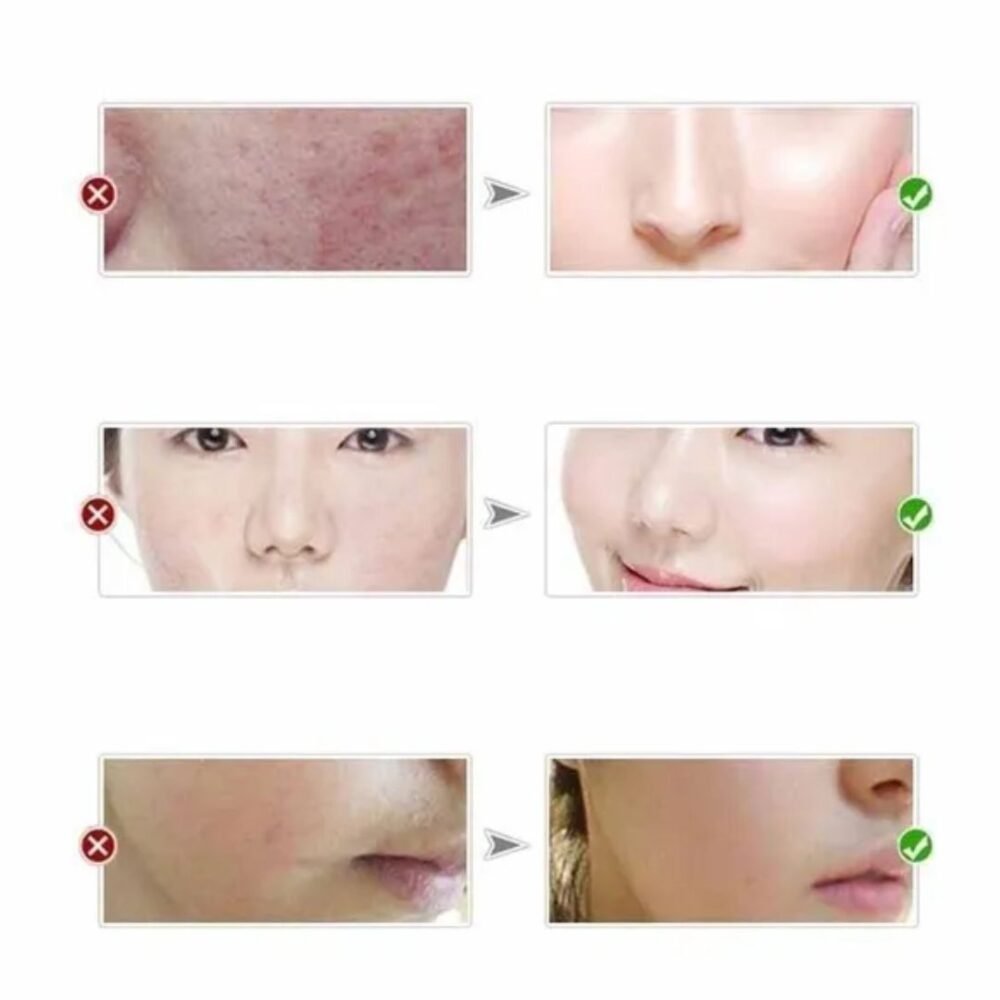 You Bello Night Cream – Glutathione Radiance & Skin Balance (Imported)