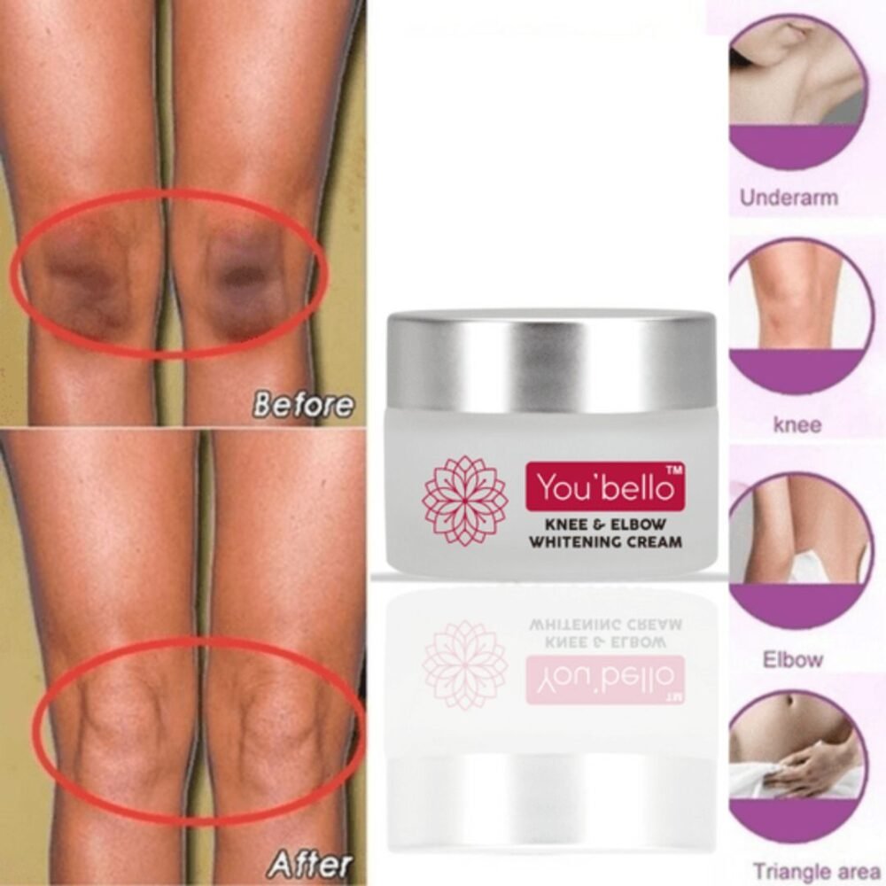 You Bello Nourishing Cream for Knee and elbow – With Kojic Acid & Glutathione