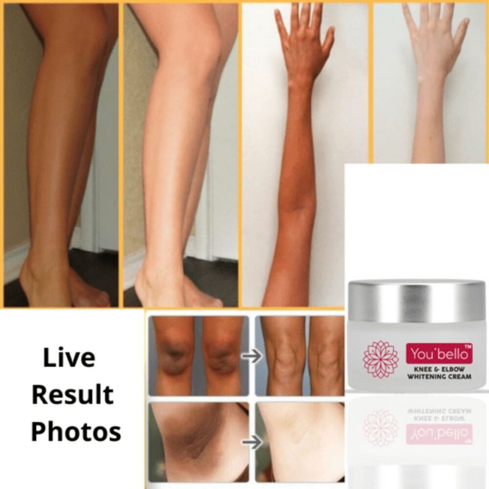 You Bello Nourishing Cream for Knee and elbow – With Kojic Acid & Glutathione
