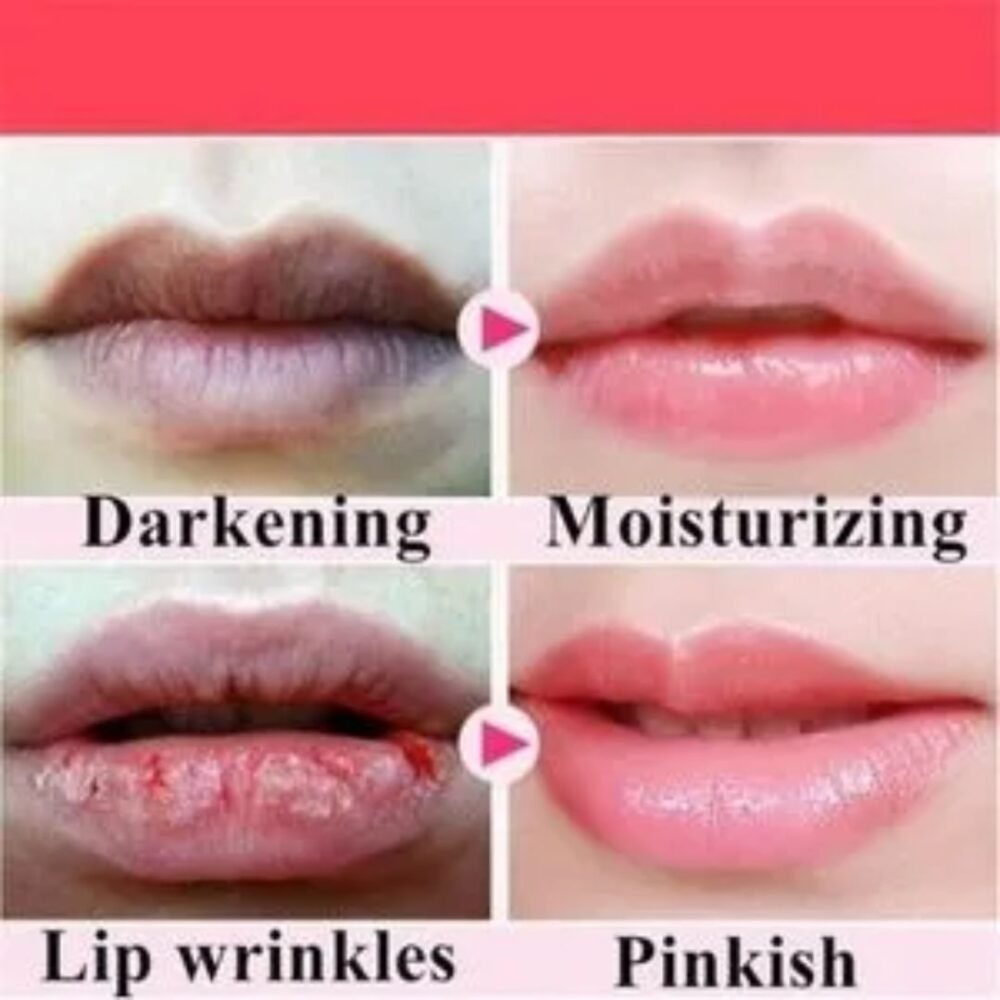 You Bello Organic Lip Lightening Gel – Hydrating Lip Repair for Dry, Dull Lips