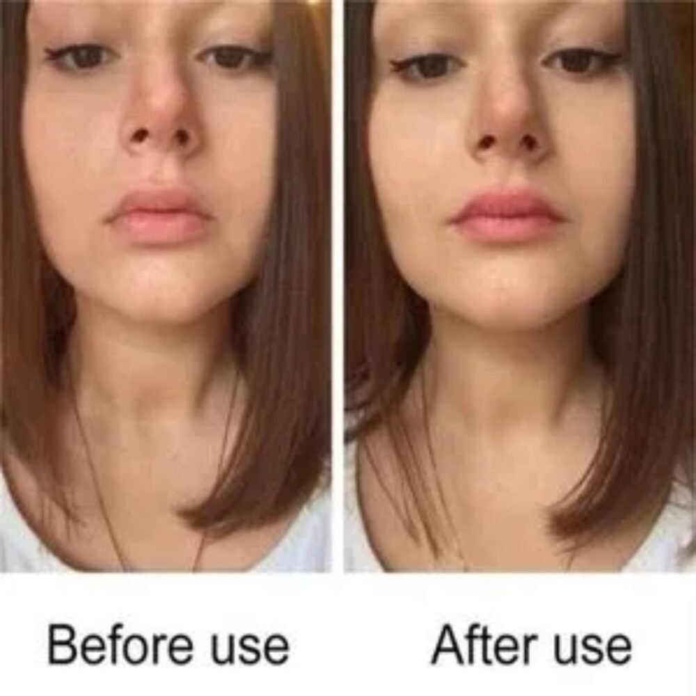 You Bello Organic Lip Lightening Gel – Hydrating Lip Repair for Dry, Dull Lips