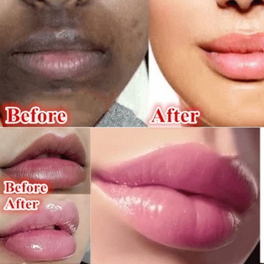 You Bello Organic Lip Lightening Gel – Hydrating Lip Repair for Dry, Dull Lips