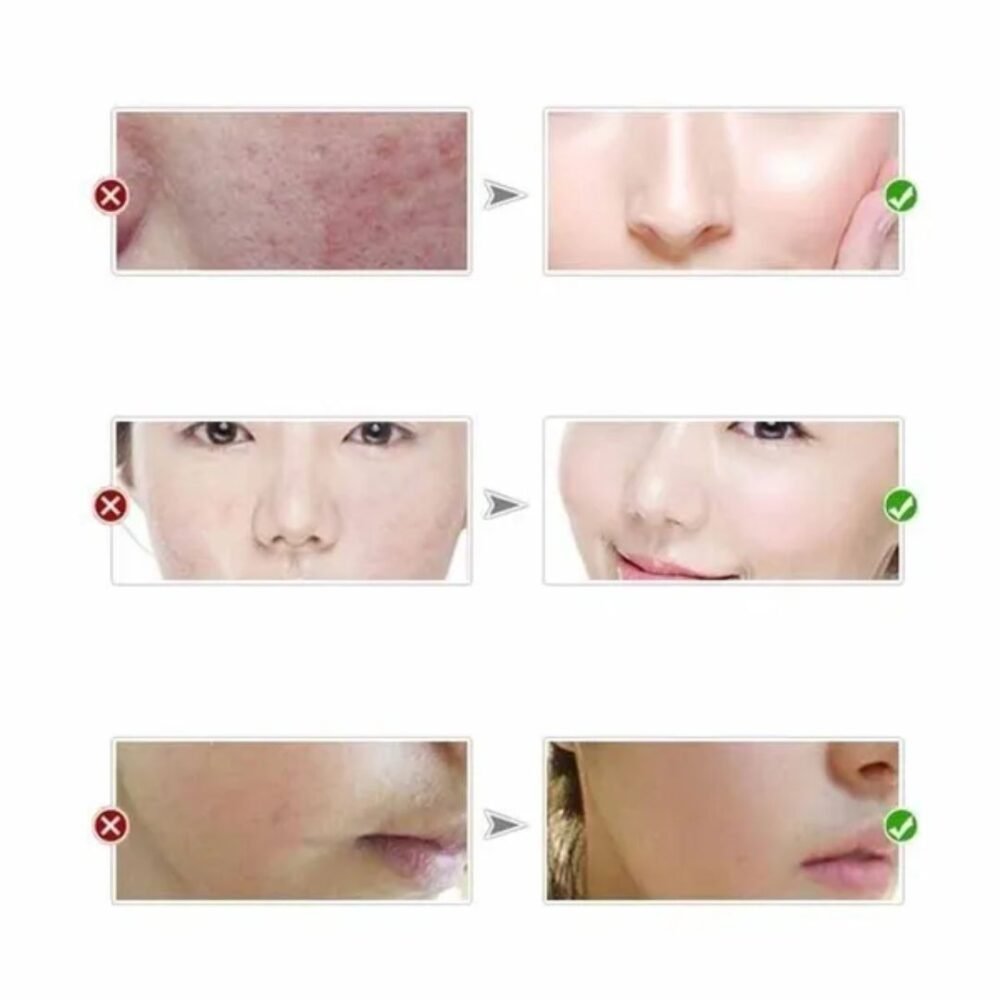 You Bello Skin Whitening Night Cream (Imported)