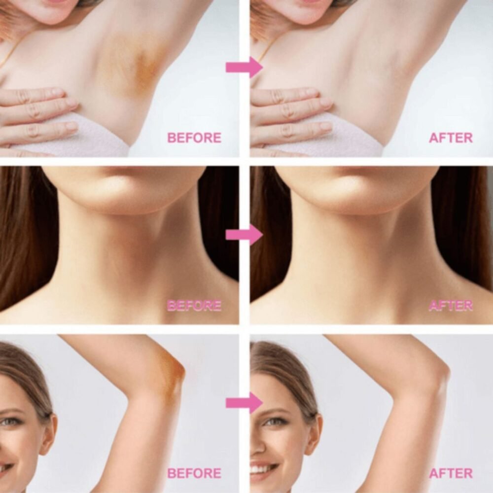 You Bello Underarm Nourishing Cream – With Citrus & Clay Extracts
